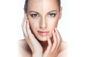 The results of the use of the cream VitalDermax it will become visible in about 15 minutes