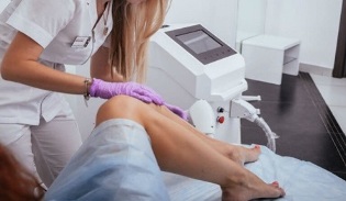 laser removes unwanted body hair