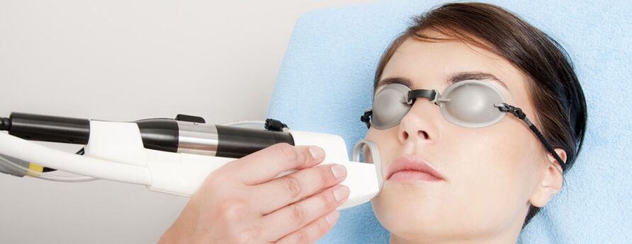 Laser rejuvenation of facial skin