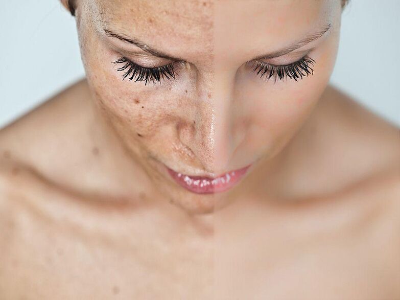 Face before and after the procedure
