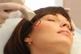 the essence of the procedure for facial skin rejuvenation with a laser